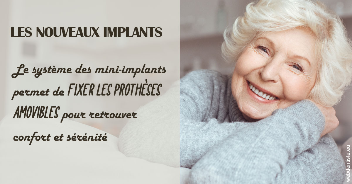 https://www.orthodontie-bruxelles-gilkens.be/Les nouveaux implants 1