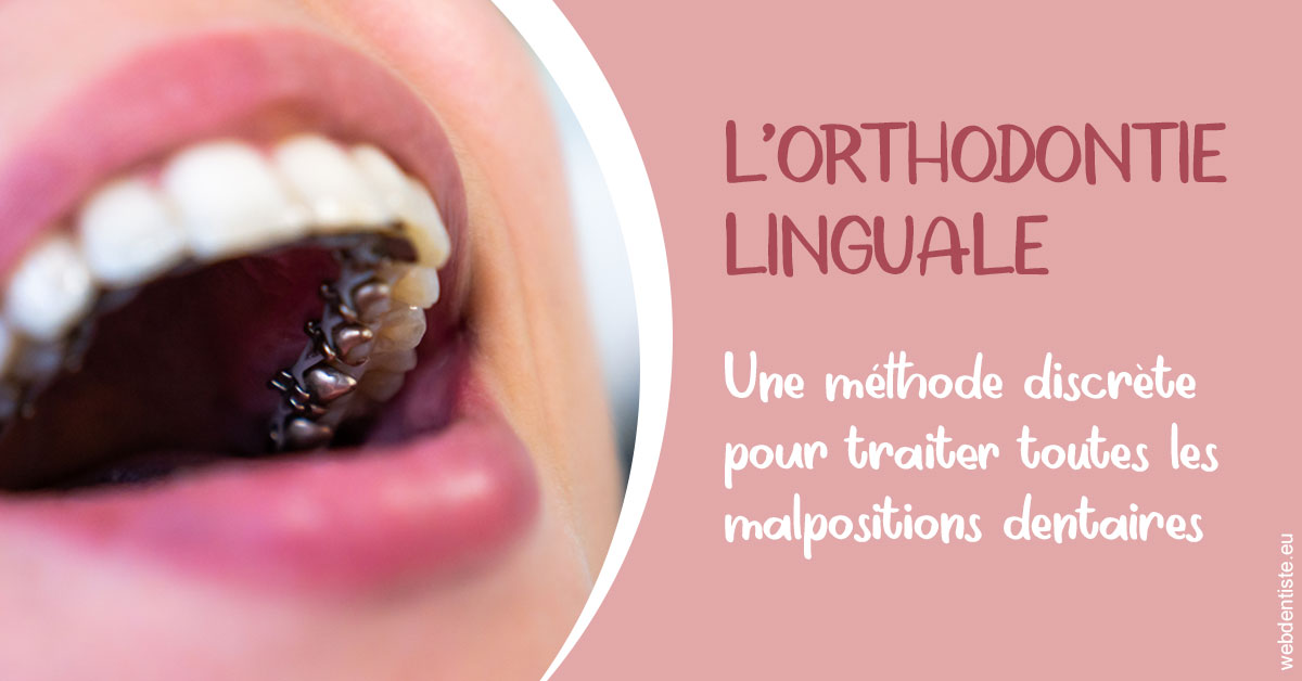 https://www.orthodontie-bruxelles-gilkens.be/L'orthodontie linguale 2