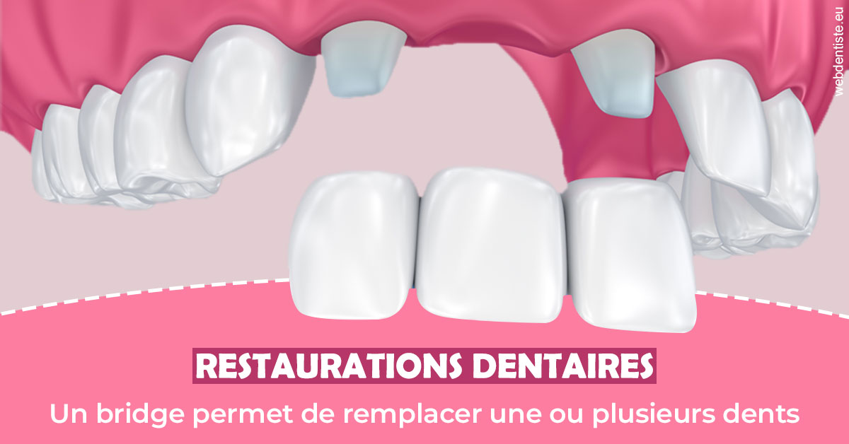 https://www.orthodontie-bruxelles-gilkens.be/Bridge remplacer dents 2