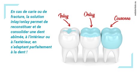 https://www.orthodontie-bruxelles-gilkens.be/L'INLAY ou l'ONLAY