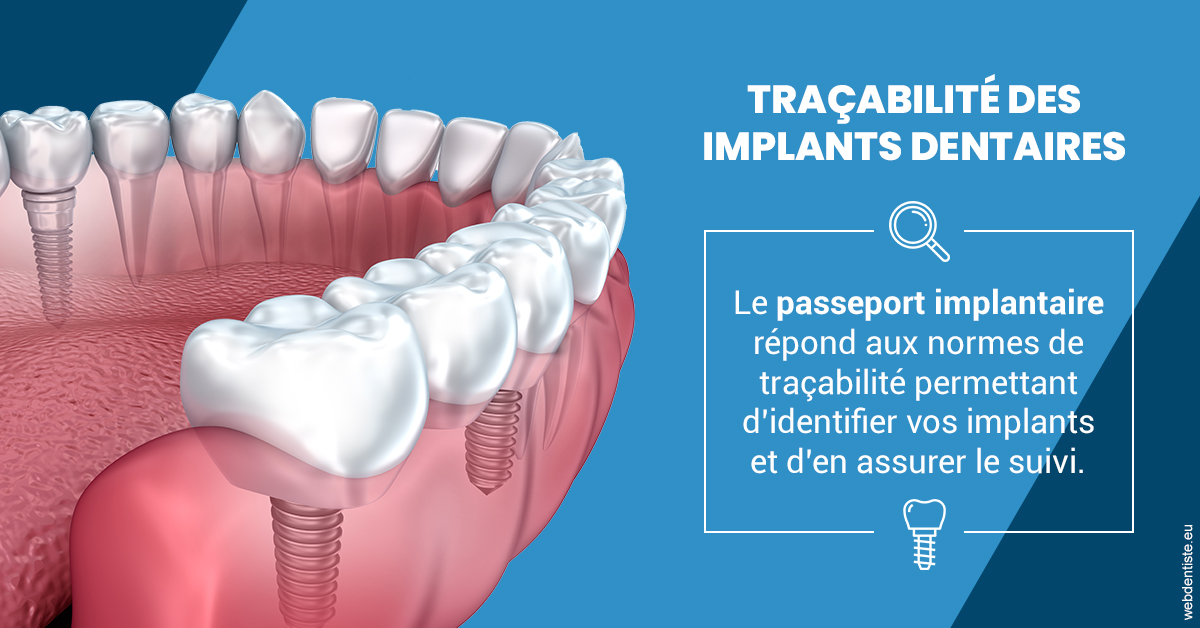 https://www.orthodontie-bruxelles-gilkens.be/T2 2023 - Traçabilité des implants 1