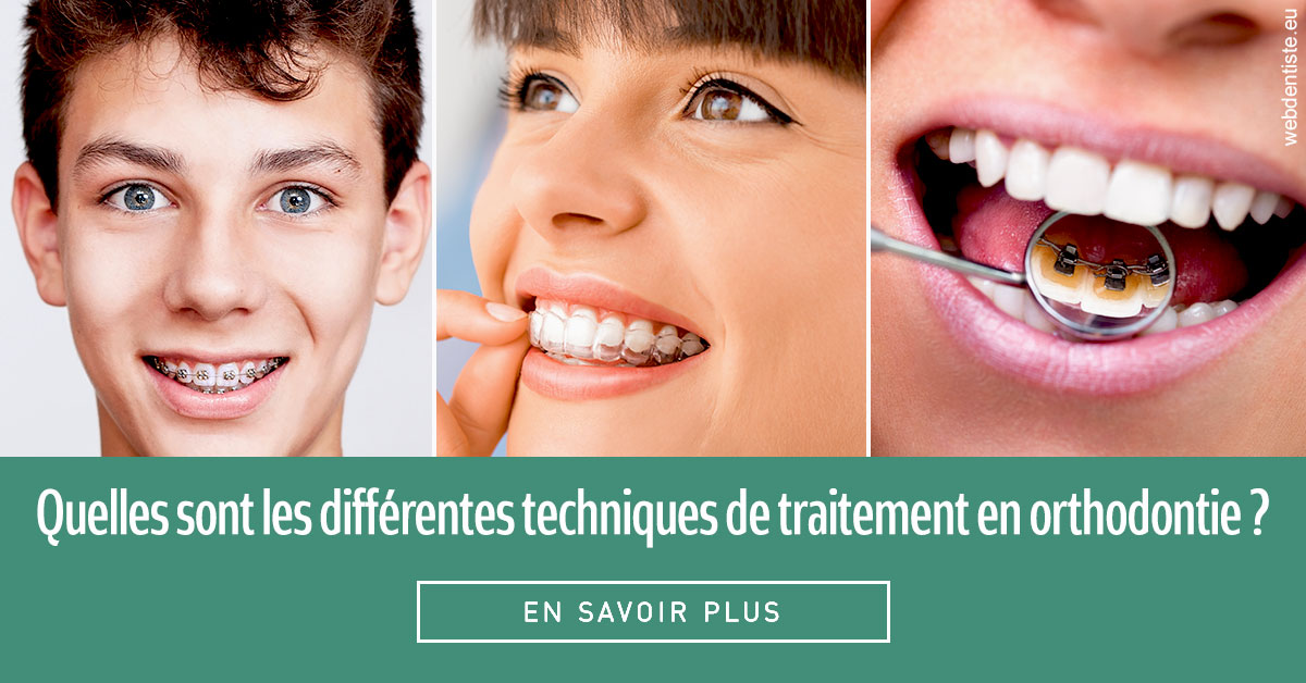 https://www.orthodontie-bruxelles-gilkens.be/Les différentes techniques de traitement 2