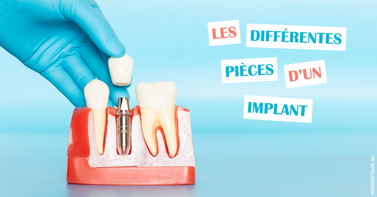 https://www.orthodontie-bruxelles-gilkens.be/Les différentes pièces d’un implant 2