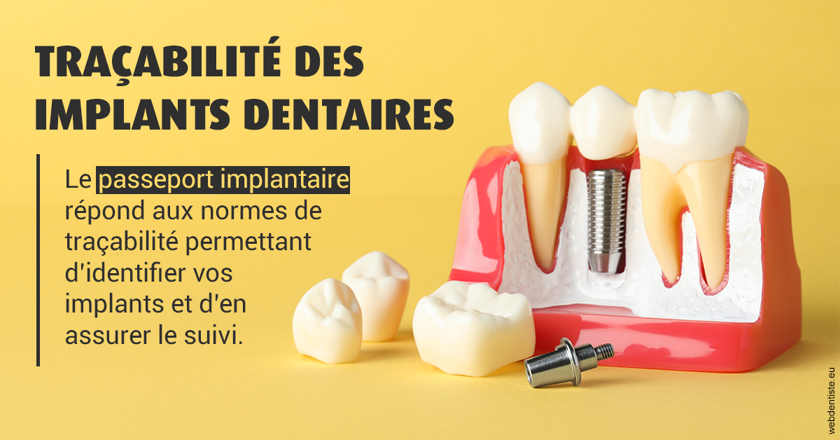 https://www.orthodontie-bruxelles-gilkens.be/T2 2023 - Traçabilité des implants 2