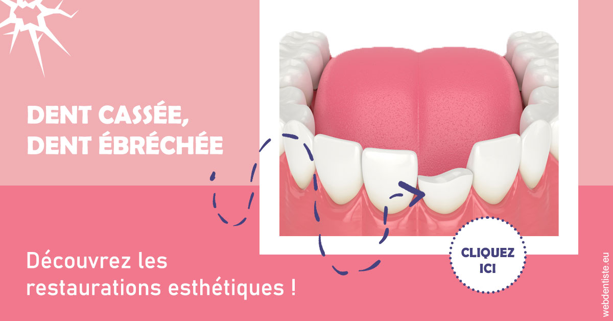 https://www.orthodontie-bruxelles-gilkens.be/Dent cassée ébréchée 1