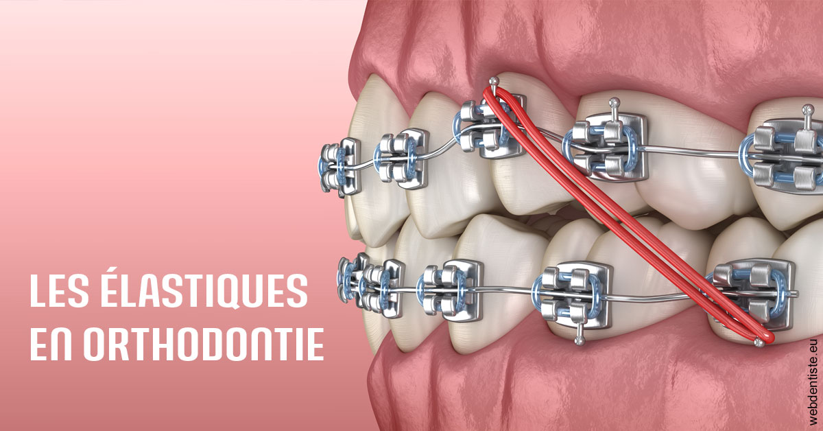 https://www.orthodontie-bruxelles-gilkens.be/Elastiques orthodontie 2