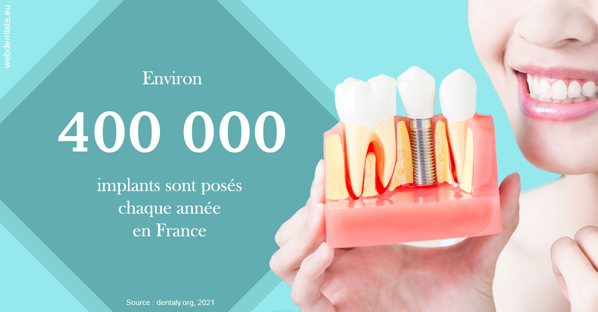 https://www.orthodontie-bruxelles-gilkens.be/Pose d'implants en France 2