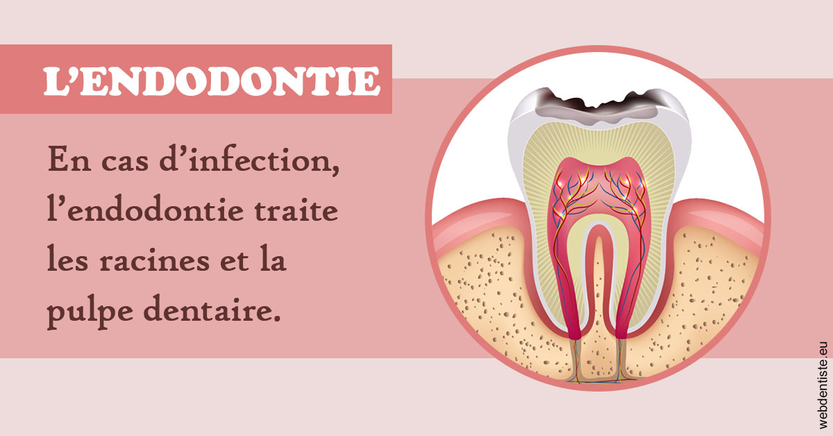 https://www.orthodontie-bruxelles-gilkens.be/L'endodontie 2